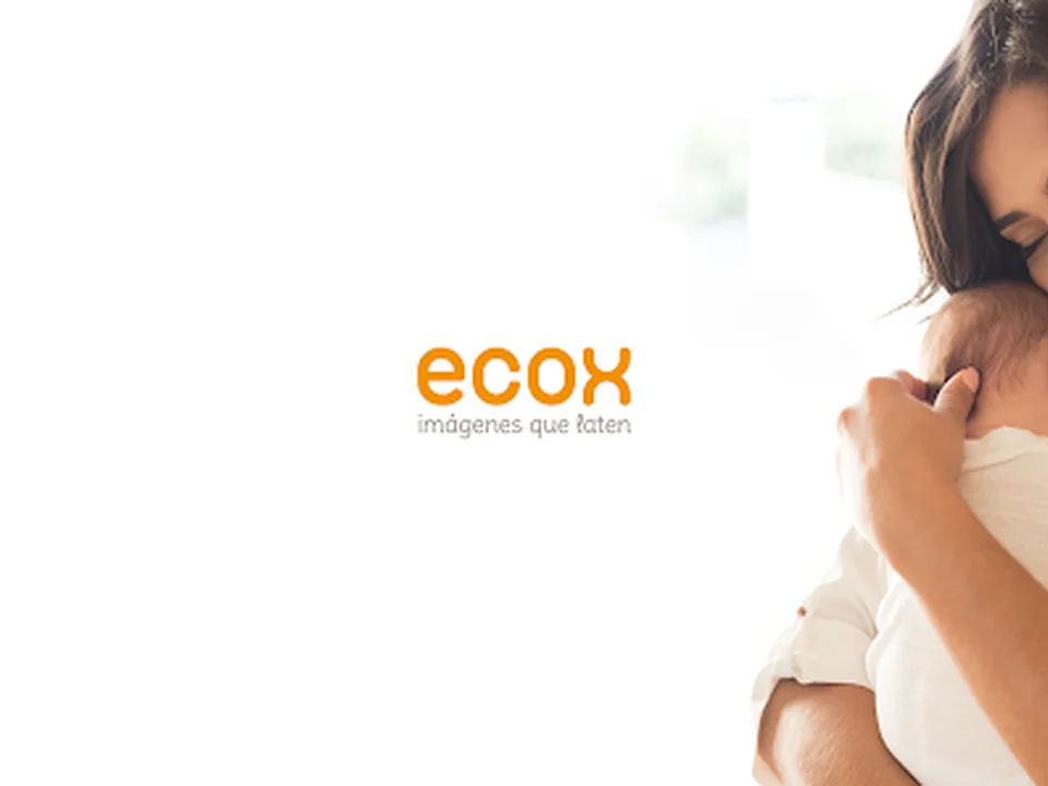 Ecox Madrid, 4 Caminos | Ecografías 5D, 4D y 8K
