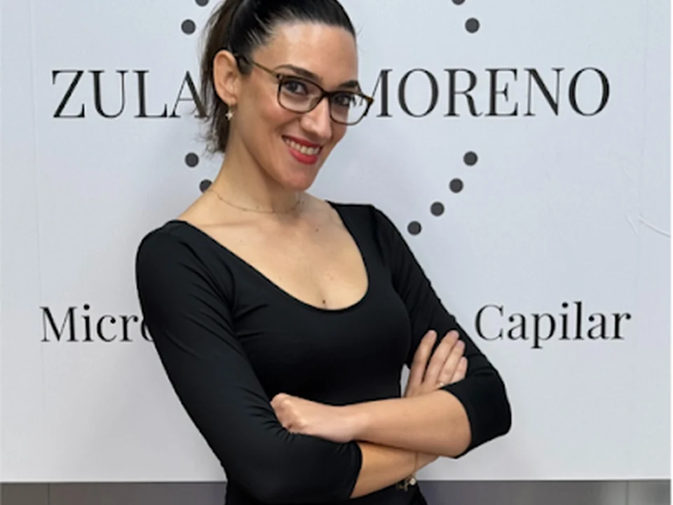 Zulayka Moreno Micropigmentación Capilar en Madrid