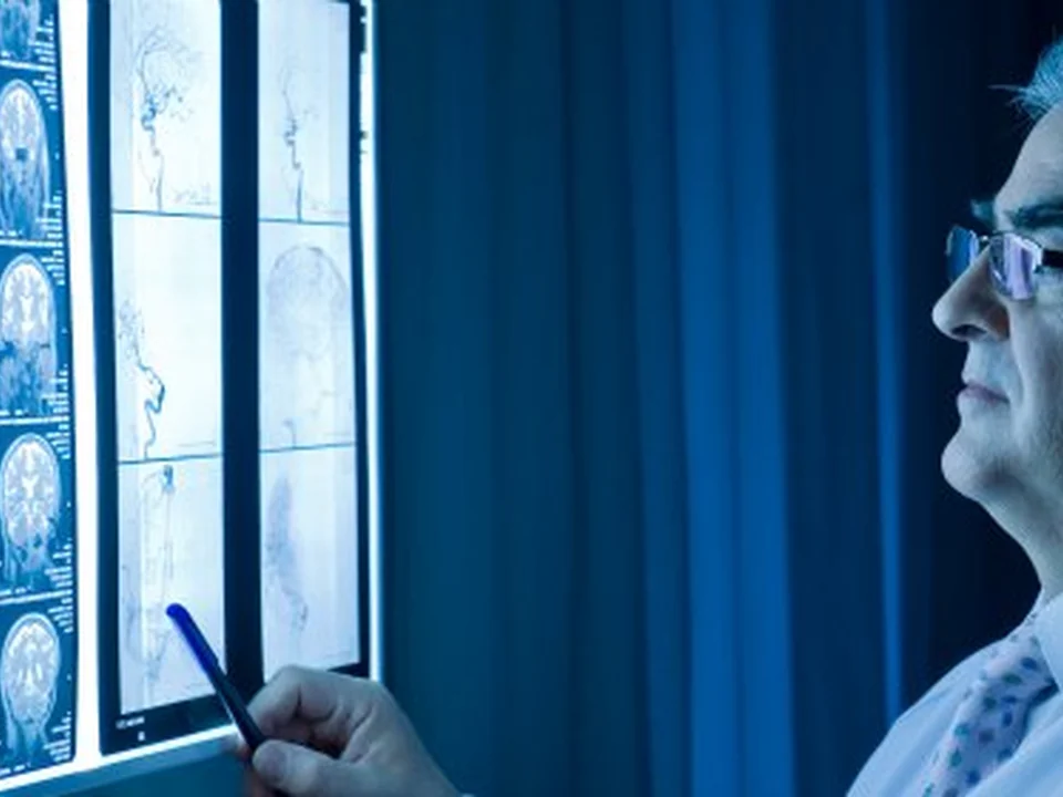 Dr. Rafael García de Sola, Neurocirujano, Madrid