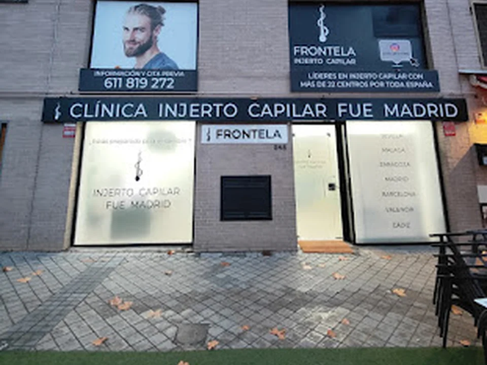 Clínica de Injerto Capilar Frontela - Madrid